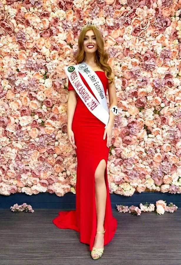26岁模特夺“英国小姐”选美冠军！甜美可人却因红发被同学打骂